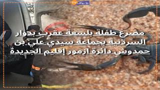 مصرع طفلة بلسعة عقرب بدوار السردنية بجماعة سيدي علي بن حمدوش دائرة ازمور